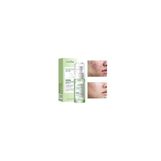 Acne Repair Serum With 3% Salicylic Acid