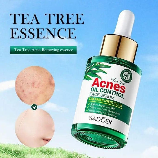 Acne Serum