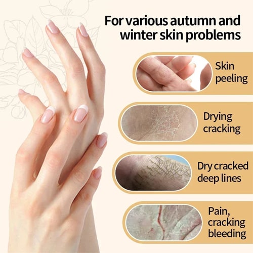 Collagen Anti-wrinkle Hand Cream Skin Soften Nourish Anti-drying Whitening Moisturizing African Skin Care Cracked Repair Products Hand Creams & Lotions
