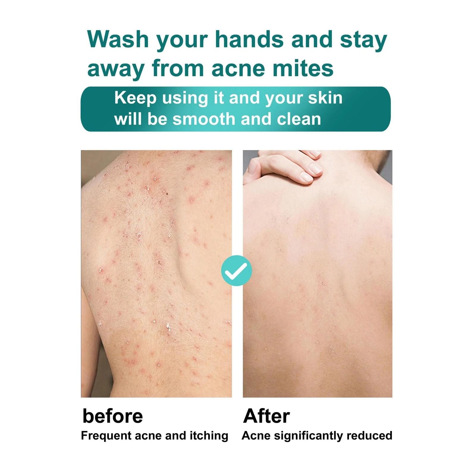 ROUSHUN Shea Butter & Coconut Oil Scrub Shower Gel Super Glowing & Anti-wrinkle Good Quality 1000ml Removes Acnes Clear Pimples Cleans and Hydrates Glow and Shine