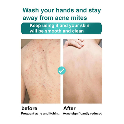 ROUSHUN Shea Butter & Coconut Oil Scrub Shower Gel Super Glowing & Anti-wrinkle Good Quality 1000ml Removes Acnes Clear Pimples Cleans and Hydrates Glow and Shine