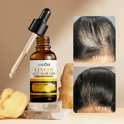 Hair Growth oil Serum Sadoer Ginger Essence Hair Care Serum minoxidil Hair Softening and Hair Moisturizer use with a Derma roller 0.5mm for best hair growth results SadoerHairSerum 30ml