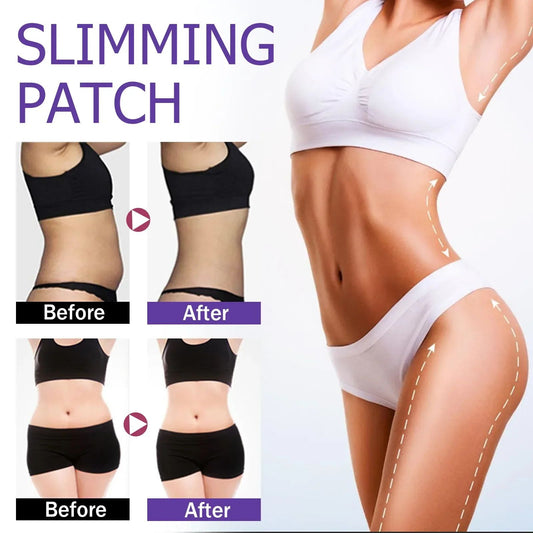 30Pcs Slim Patch Fat Burner Belly Abdomen Slimming Fat Burning Stick Weight Loss Slimer Tool Wonder Quick Slimming Patch