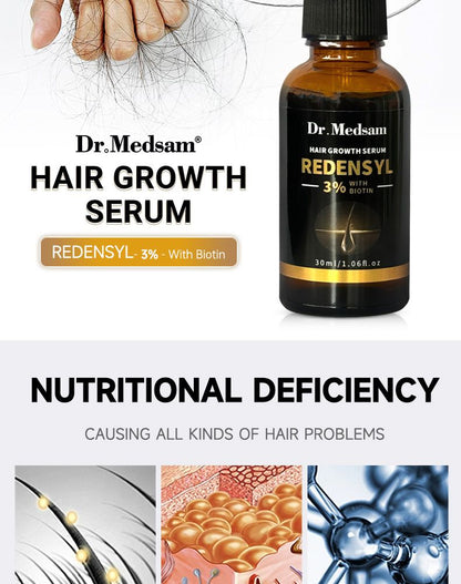 Castor oil Biotin Hair Growth Solution Hair Growth Rosemary Hair Essence Hair Care Loss Products