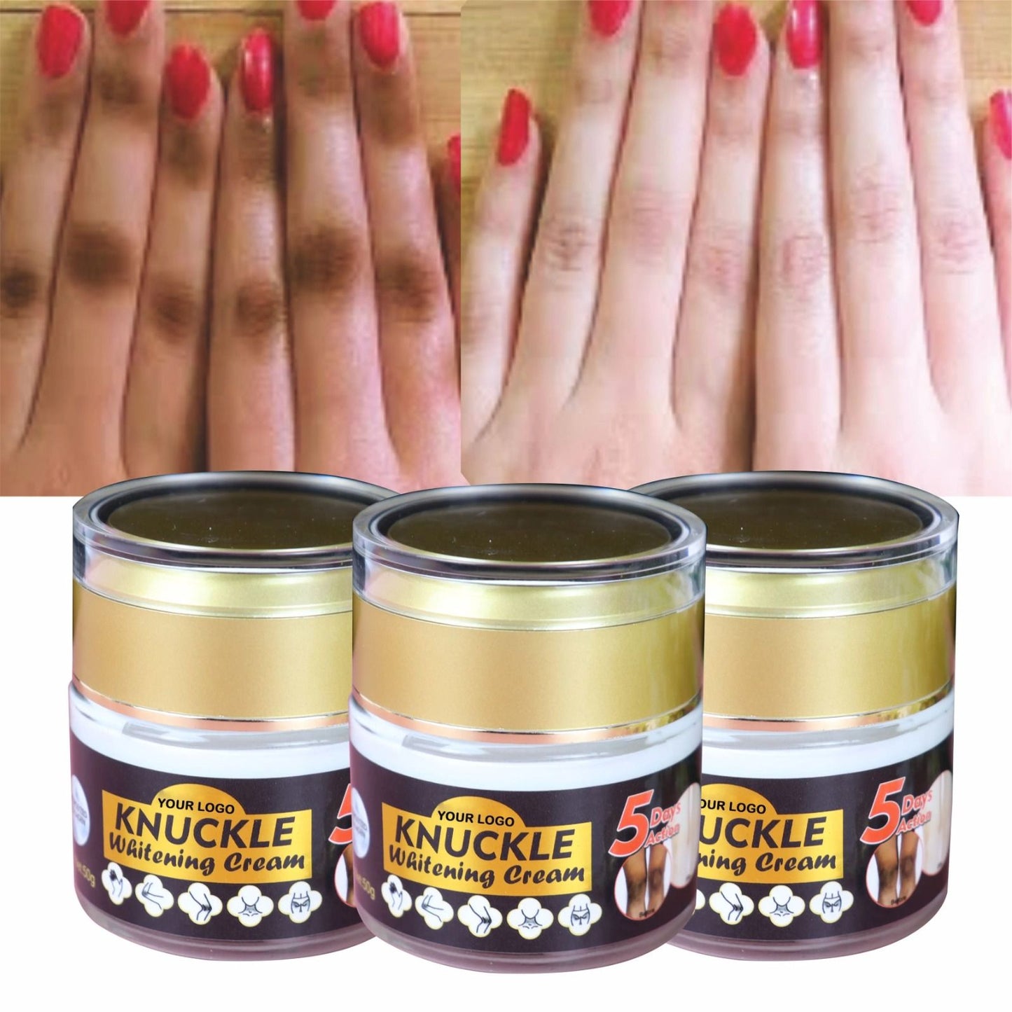 O' Carly Knuckle Whitening Cream Dark Spots Dark Elbow Removal Moisturizing Removing Dark knuckles Beauty Cream Personal Care Body Care Knuckle Whitening Cream