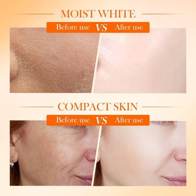 Sadoer 2 in 1 Skin Active 5x Vitamin C Cream + 5 x Vitamin C Serum Complementary, For Deep Hydration, Whitening Dark Spots, Moisturizing, Skin Tone Brightening and Skin Nourishment
