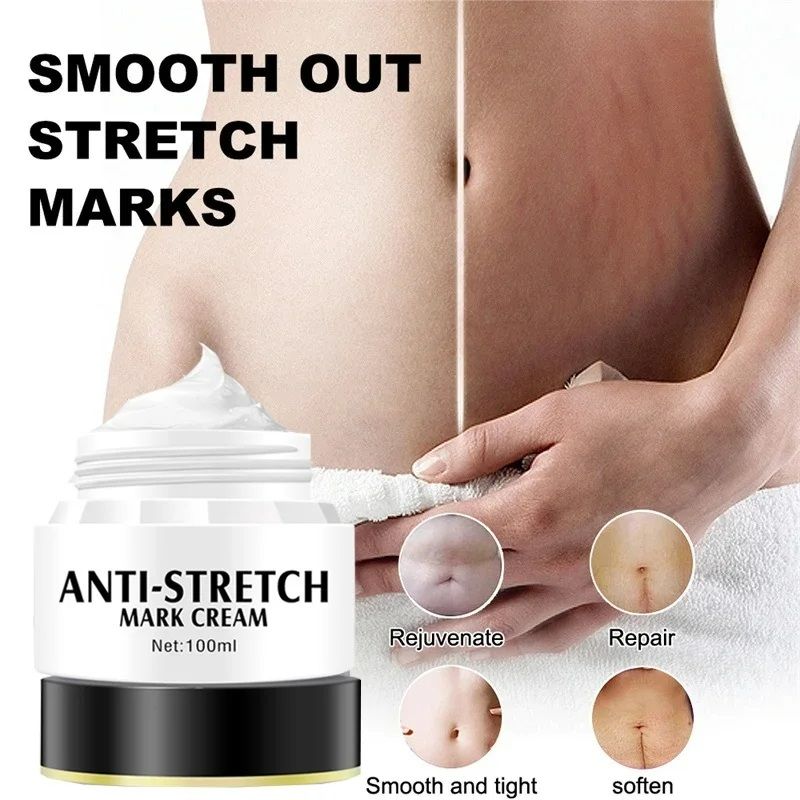 Removes Stretch Mark Cream Postpartum Pregnancy Scars Repair Creams Anti-Aging Anti-Wrinkles Maternity Skin Repair Treatment Body Moisturizing Brighten Skin Care Cream