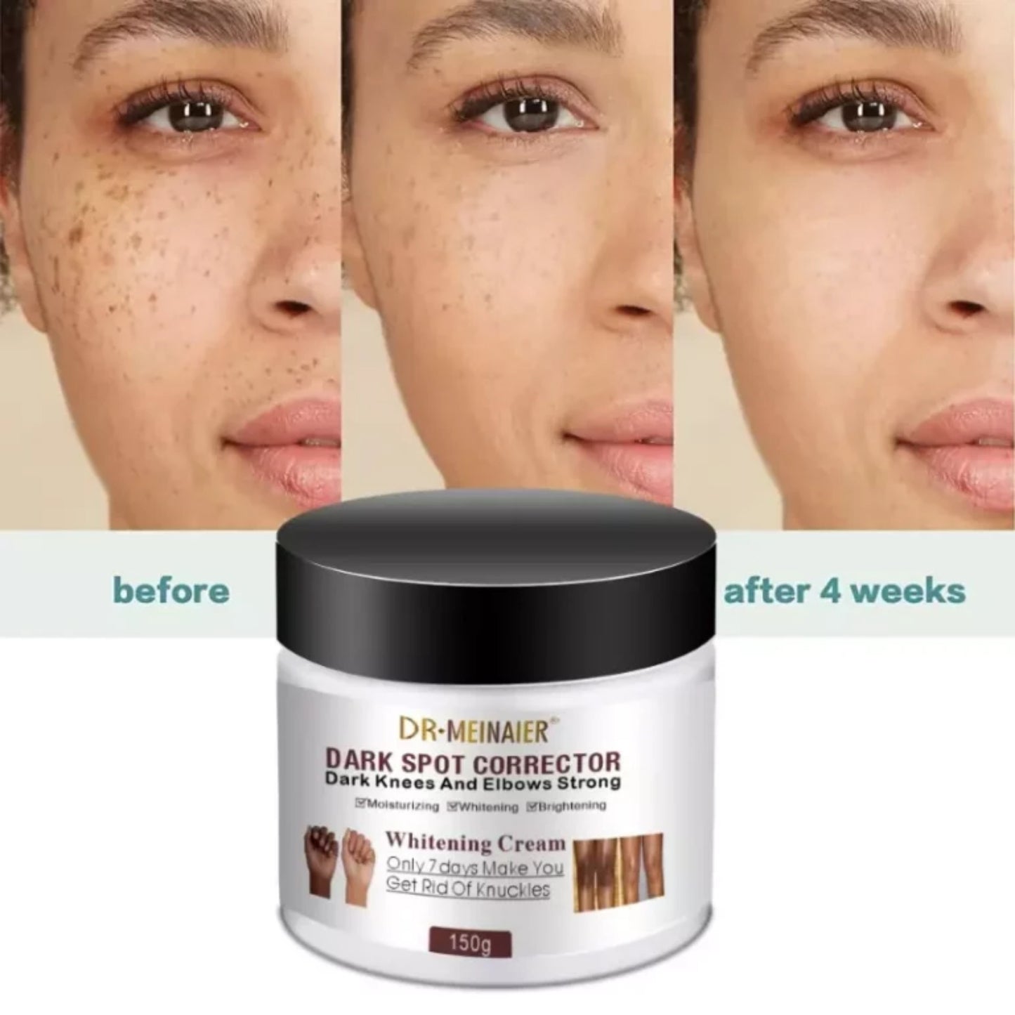 Dr. Meinaier Dark Spot Corrector Cream Whitening Brightening Knuckles Clears Spots Underarm knees & elbow