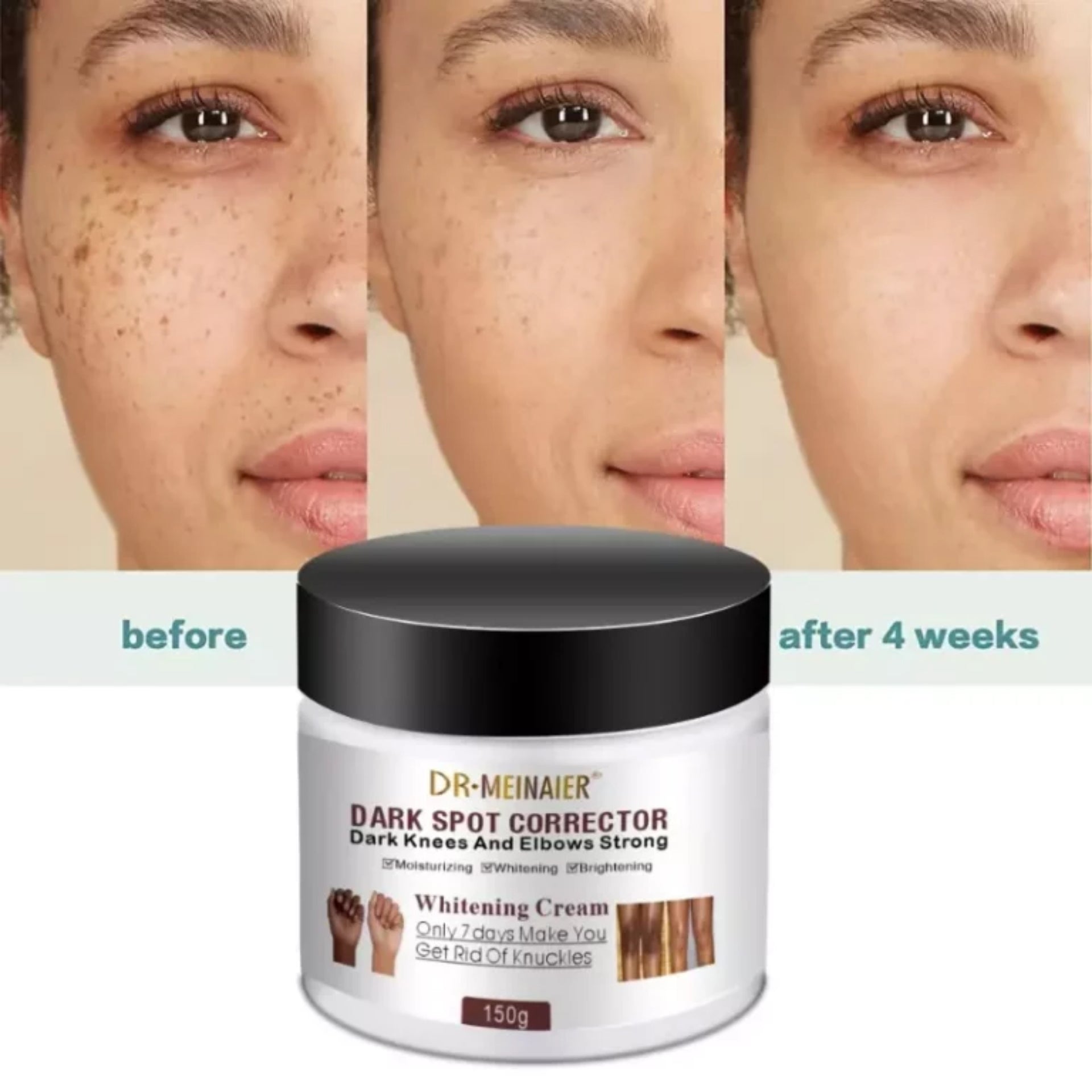 Dr. Meinaier Dark Spot Corrector Cream Whitening Brightening Knuckles Clears Spots Underarm knees & elbow