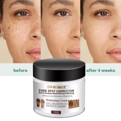 Dr. Meinaier Dark Spot Corrector Cream Whitening Brightening Knuckles Clears Spots Underarm knees & elbow