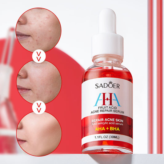 AHA + BHA Fruit Acid Acne Repair Serum, With Salicylic Acid , Shrinks Pores, Eliminates Acne, Nourish and Smoothens Skin, Repair Acne Marks, Can Combine with Vitamin C, Mois 30ml