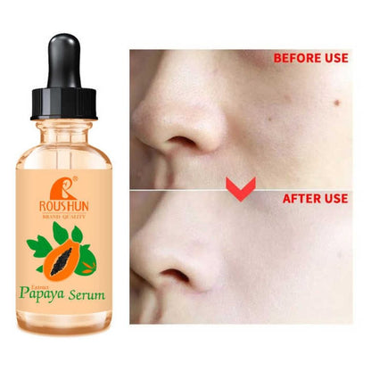 Roushun Papaya Serum Acne Triple Clear Ange Spots Sun Damage Skin Repair Tone Face Facial Serum