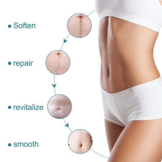 2Roll Silicone Scar Sheets Keloid Bump Removal Strips, Scar Reducing Treatments Surgical Scars,Burn,Tummy Tucks,Acne,C-Section