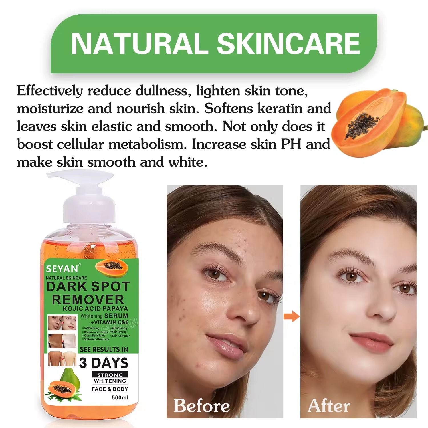 Seyan Dark Spot Remover 500ml – Powerful Skin Lightening & Brightening Cream for Face & Body – Fades Dark Spots, Acne Marks, Hyperpigmentation & Uneven Skin Tone for Radiant, Smooth Skin