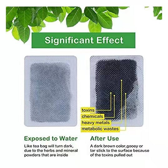 10pcs/box Detox Foot Patches Pads Body Toxins Feet Slimming Cleansing Herbal Body Health For Weight Loss