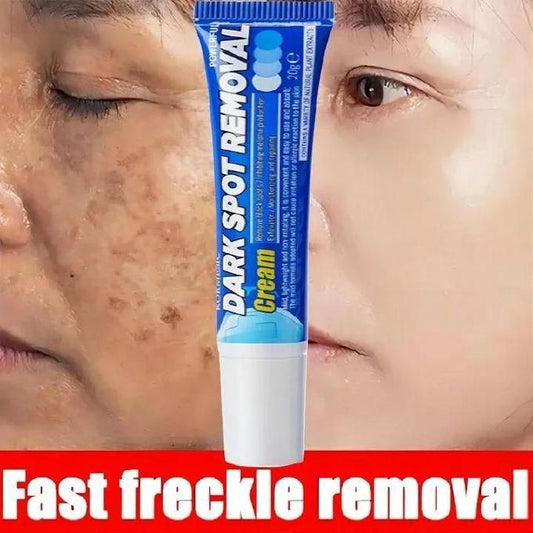 Dark Spot Removal Cream