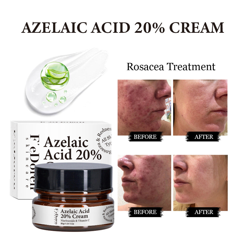 Azelaic Acid 20% Whitening Fades Acne Cream Freckle Remove Melasma Dark Pigment Spots Melanin Alpha Arbutin Face Cream Skin Care