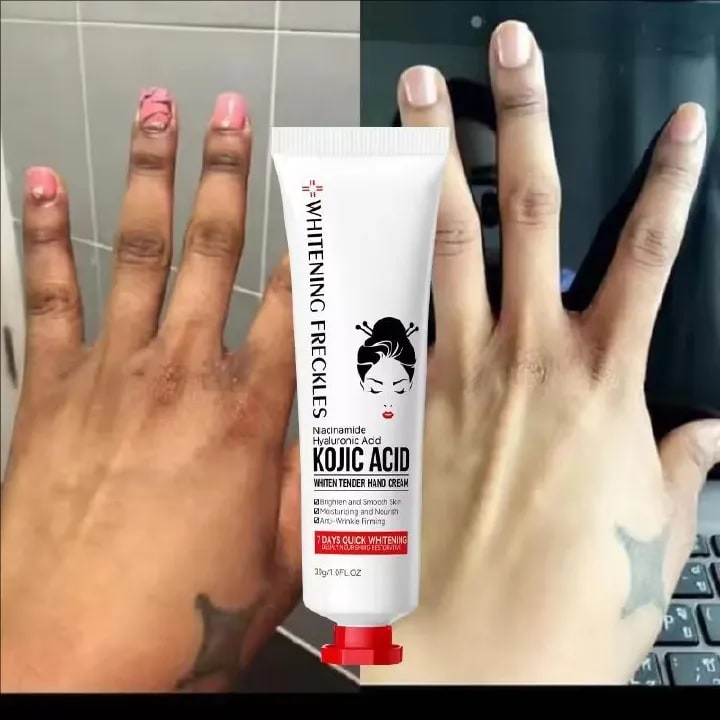 Fade Dullness Hand Cream Anti-wrinkle Remove Cracked Lotion Body Fast Lighten Black Skin Brighten Smooth Nourish Moisturizer 30g