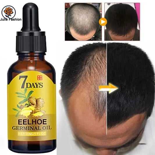Hair Growth Products Ginger Fast Growing Hair Essential Oil Beauty Hair Care Prevent Hair Loss Oil Scalp Treatment For Men Women