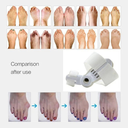Orthopedic Bunion Corrector 1 PCS Hallux Valgus Brace Splint Pads Bunion Big Toe Separators Straightener Universal for Left and Right Feet