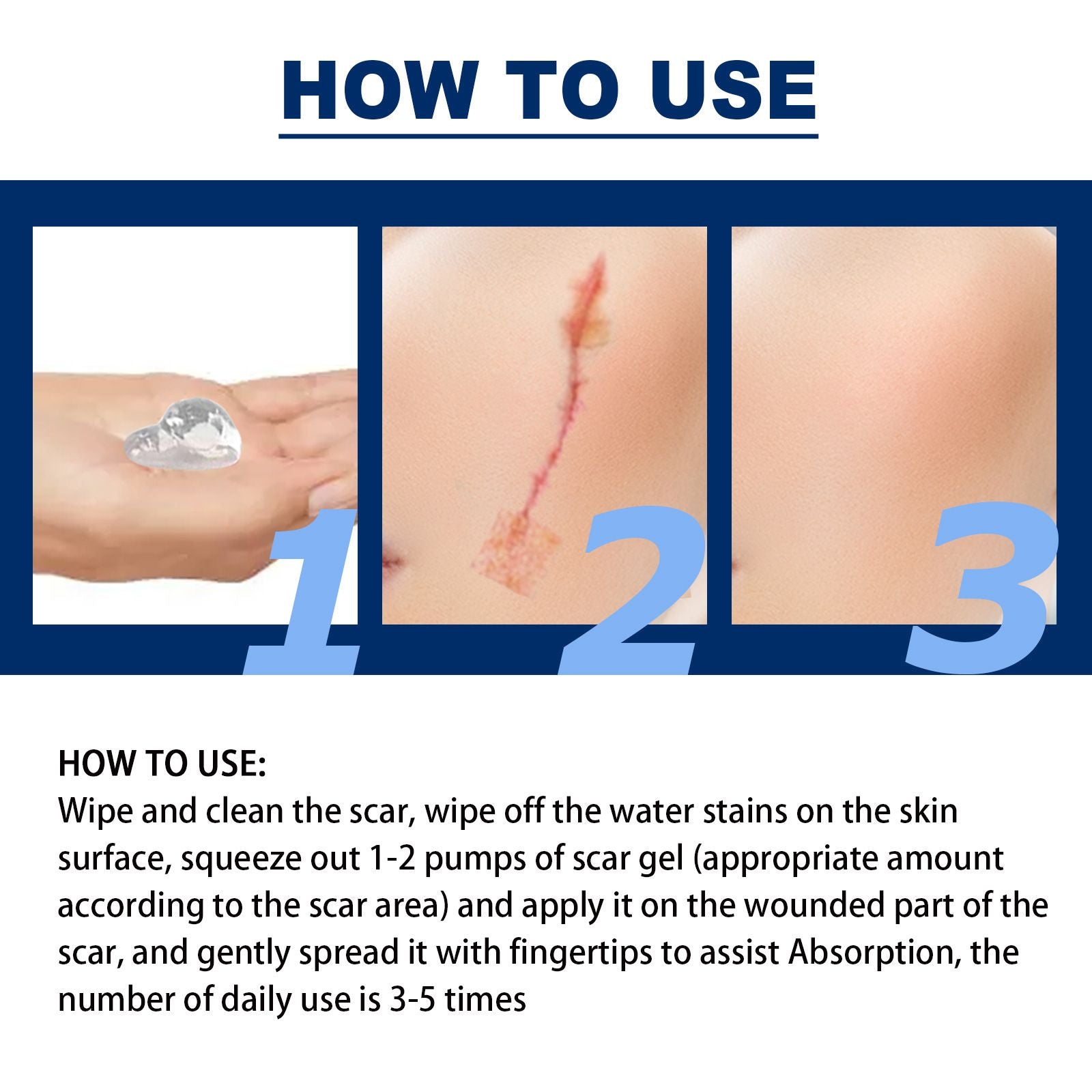 Silicone Scar Removal Gel Removal Skin Scars Cream Treat Surgery Scars Stretch Marks Acne Pox Prints Burn Repair Facial Care Gel Whitening Pigmentation Corrector