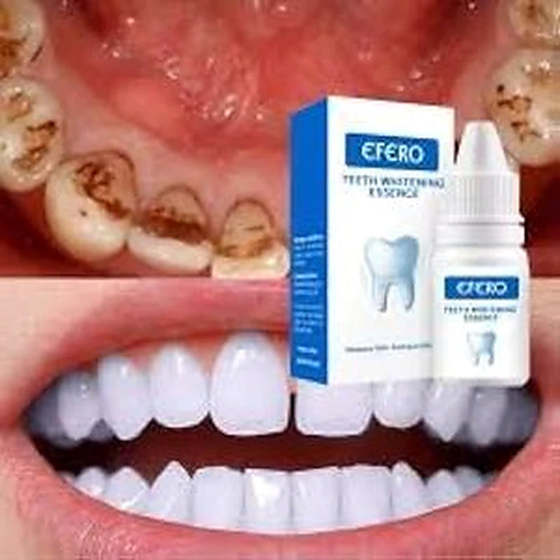 Teeth whitening product with a close-up of teeth before and after whitening.