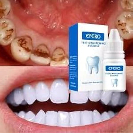 Teeth whitening product with a close-up of teeth before and after whitening.