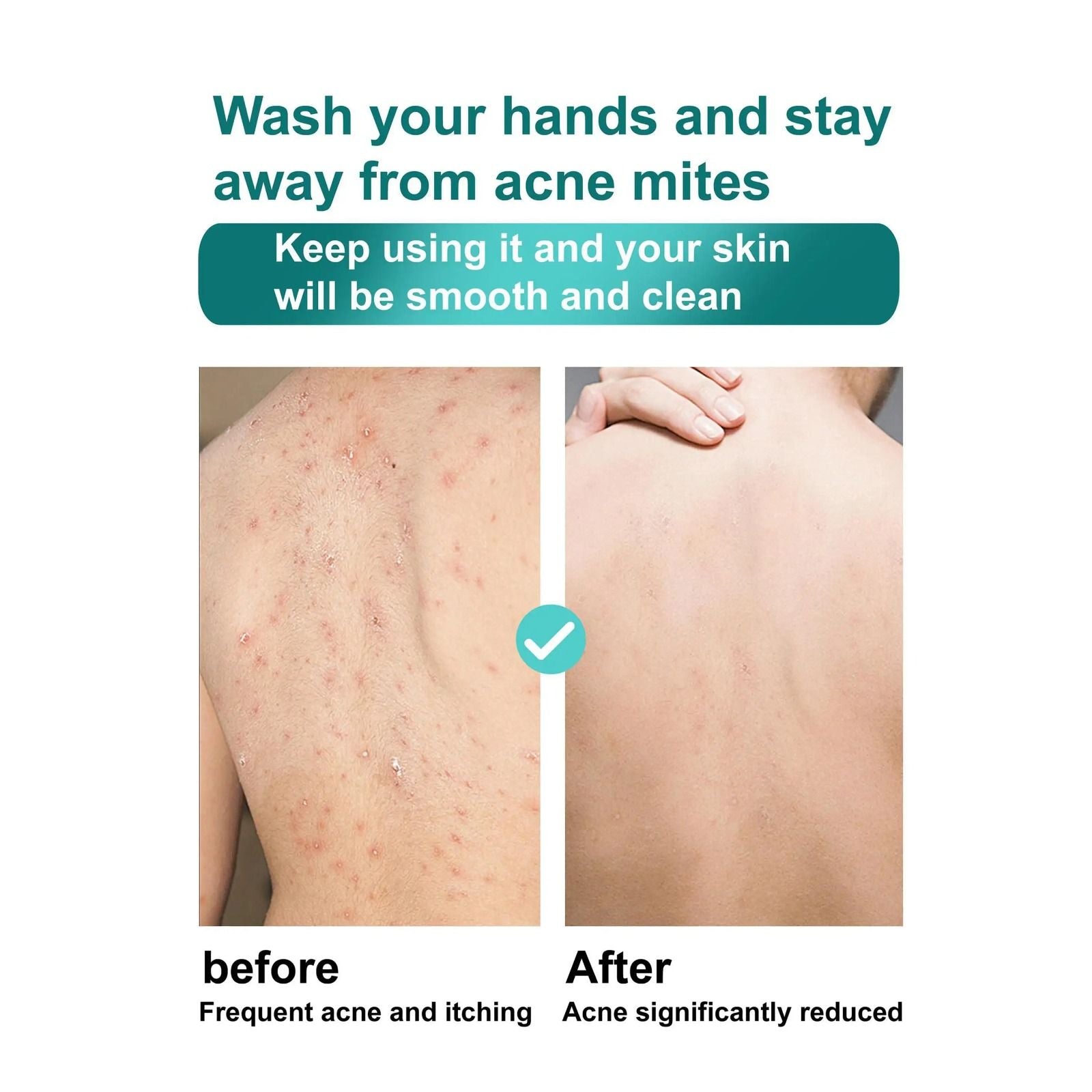 ROUSHUN Half Cast Scrub Shower Gel Fast Whitenng Shower Gel Deeply Cleanses Rich and Creamy blend Softer Skin After Wash Removes Acnes Clear Pimples Cleans and Hydrates Glow and Shine 1000ml