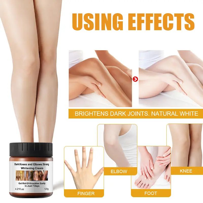 MOOYAM Dark Knees, Elbows and Knuckles Strong Whitening Cream In 7 Days Brightening