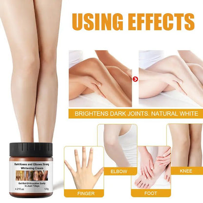 MOOYAM Dark Knees, Elbows and Knuckles Strong Whitening Cream In 7 Days Brightening
