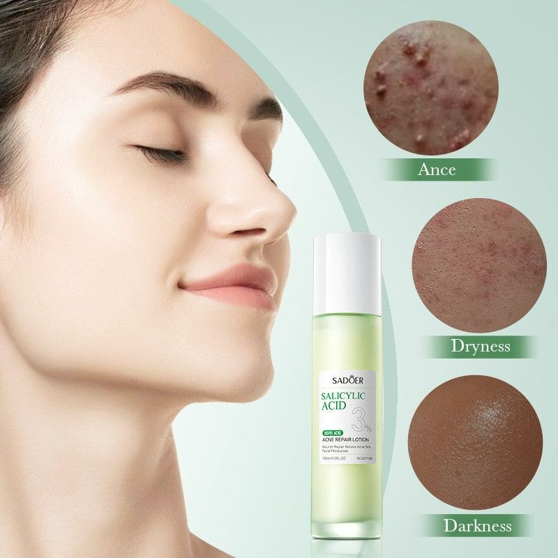 SADOER 9PCS Skin Care Set Salicylic Acid Set Dispel Acne Repair Face Cream + Lighten Acne Marks Face Cleanser + Anti-Acne Repair Toner + Acne Removal Face Serum + 5PCS Acne Sooth Hydrate Facial Masks
