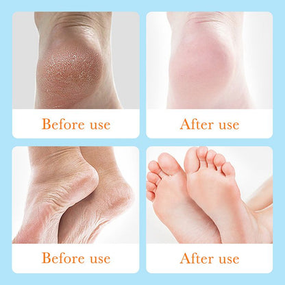 Foot Anti Chapped Gel,Moiturizing the skin,Softening keratin,Smoothing tender feet