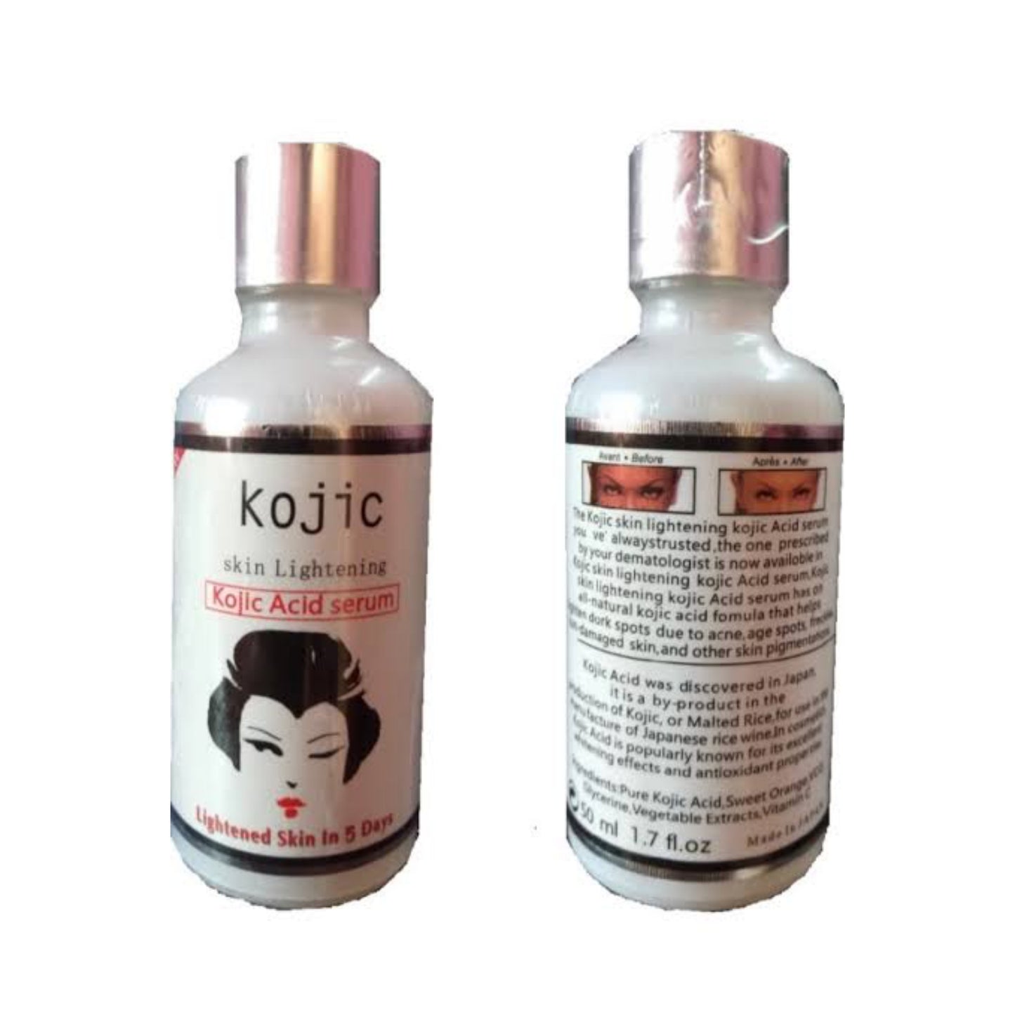 Kojic Acid Lotion + Serum Kojie San Skin Face Body Lightening Brightening