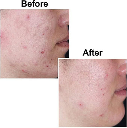 3 Packs Kojie San Original Kojic Acid Skin brightening & Lightening Soap for Men and Women orange flavour (65g Bars- Pack of 3) Philippines Imported Dermatologically Tested Paraben Free