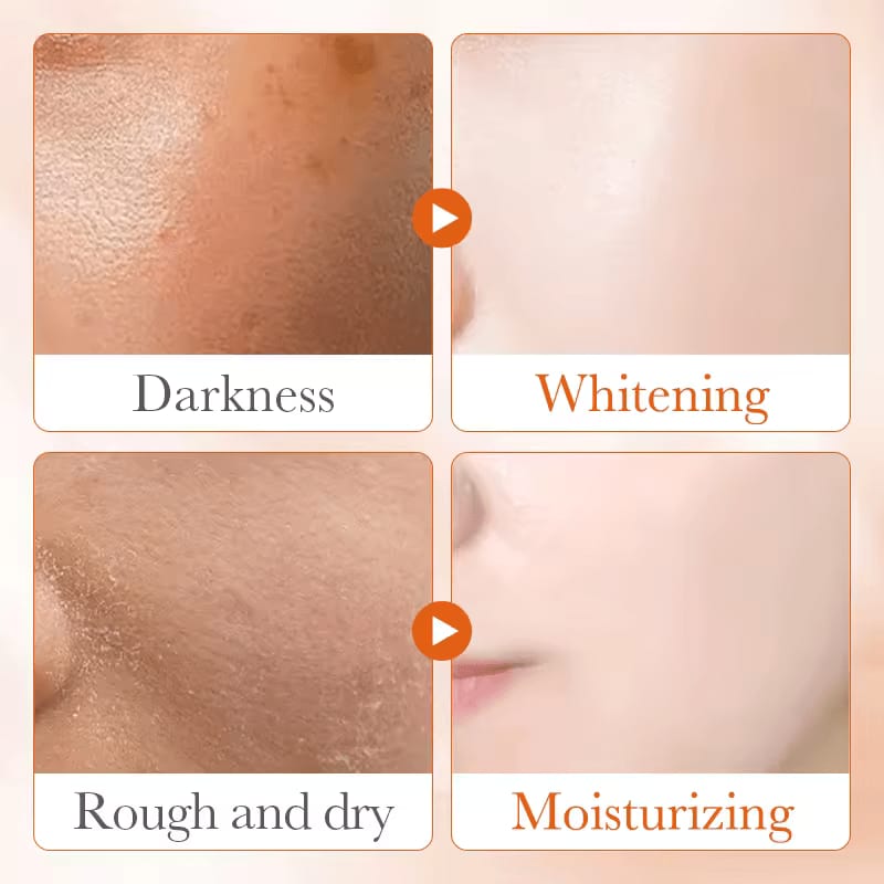 Sadoer 2 in 1 Skin Active 5x Vitamin C Cream + 5 x Vitamin C Serum Complementary, For Deep Hydration, Whitening Dark Spots, Moisturizing, Skin Tone Brightening and Skin Nourishment