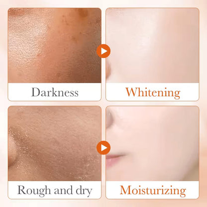 Sadoer 2 in 1 Skin Active 5x Vitamin C Cream + 5 x Vitamin C Serum Complementary, For Deep Hydration, Whitening Dark Spots, Moisturizing, Skin Tone Brightening and Skin Nourishment