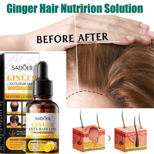 Ginger Anti Hairloss Treatment Essence, Hair Growth Restoration Anti Hair Loss Serum