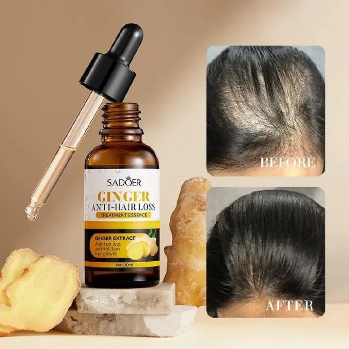 Ginger Plant Hair Growth Serum Nutrition Hair Care Hair Essence 30ml