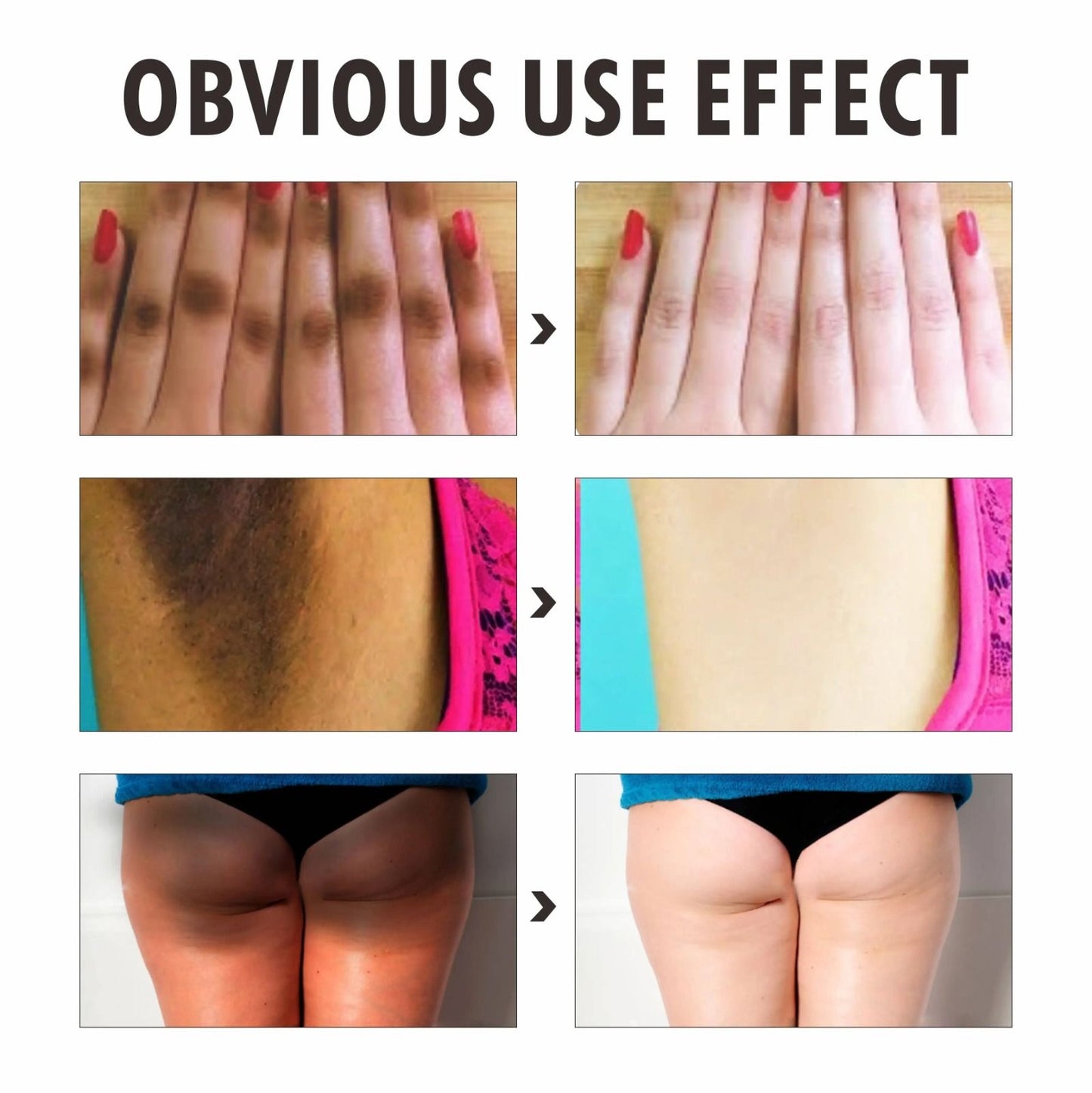 O' Carly Knuckle Whitening Cream Dark Spots Dark Elbow Removal Moisturizing Removing Dark knuckles Beauty Cream Personal Care Body Care Knuckle Whitening Cream