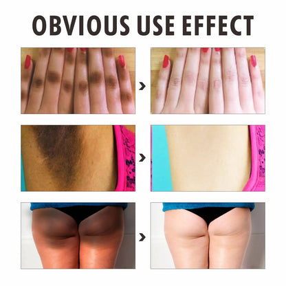 O' Carly Knuckle Whitening Cream Dark Spots Dark Elbow Removal Moisturizing Removing Dark knuckles Beauty Cream Personal Care Body Care Knuckle Whitening Cream