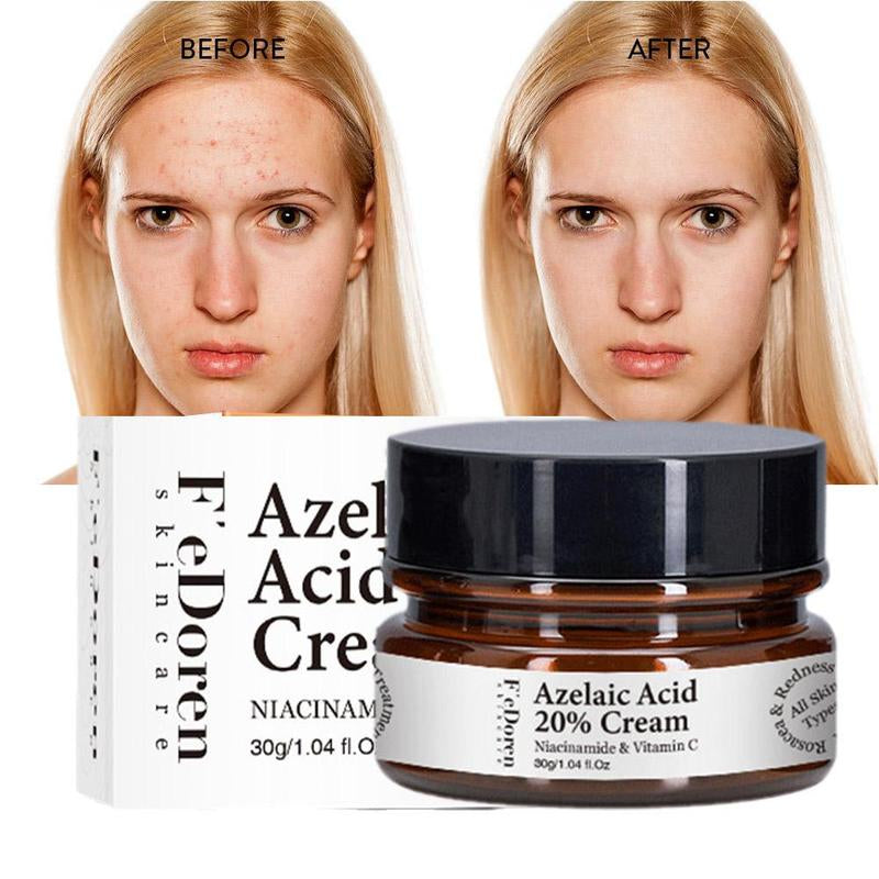 Azelaic Acid 20% Whitening Fades Acne Cream Freckle Remove Melasma Dark Pigment Spots Melanin Alpha Arbutin Face Cream Skin Care