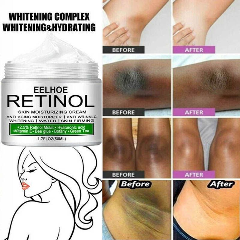 Retinol Body Whitening Cream Private Parts Underarm Inner Thigh Intimate Bleaching Serum Whiten Knee Butt Knuckles Brighten Cream