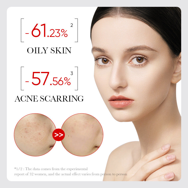 AHA + BHA Fruit Acid Acne Repair Serum, With Salicylic Acid , Shrinks Pores, Eliminates Acne, Nourish and Smoothens Skin, Repair Acne Marks, Can Combine with Vitamin C, Mois 30ml