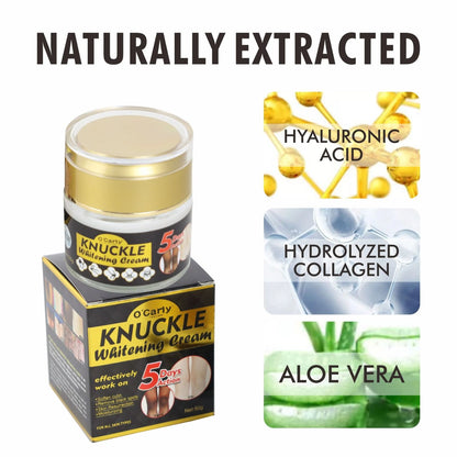 O' Carly Knuckle Whitening Cream Dark Spots Dark Elbow Removal Moisturizing Removing Dark knuckles Beauty Cream Personal Care Body Care Knuckle Whitening Cream