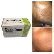 Dudu-Osun Black Soap-for Eczema,Acne,Freckle,oily Skin,Dark Spots