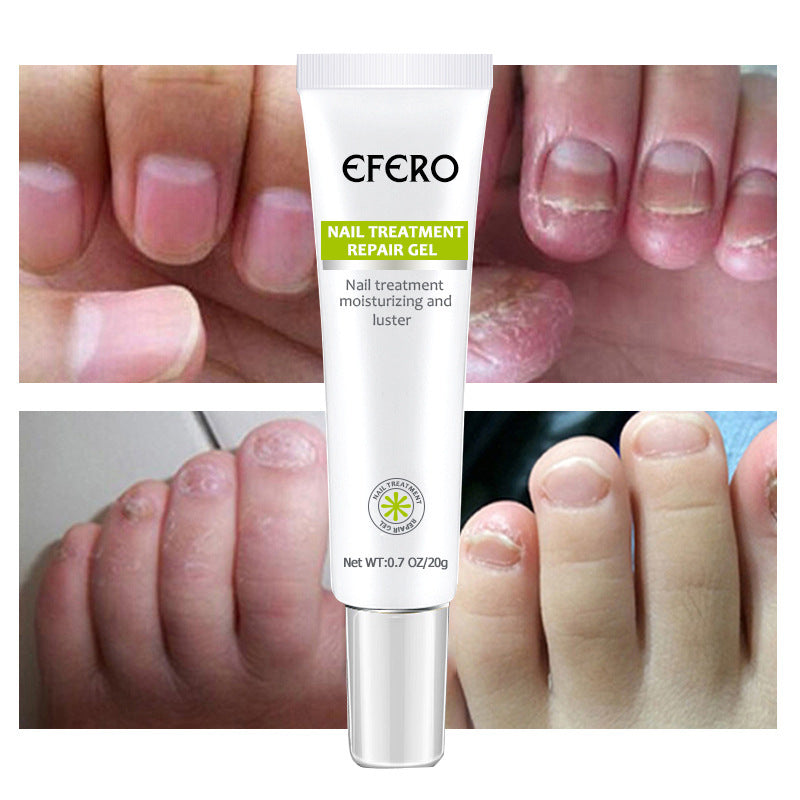 EFERO Nail Treatment Repair Cream Toe Be Health Instant Beauty Gel Cure Damaged Foot & Toenails Restores Appearance of Discolored or Damaged Nails