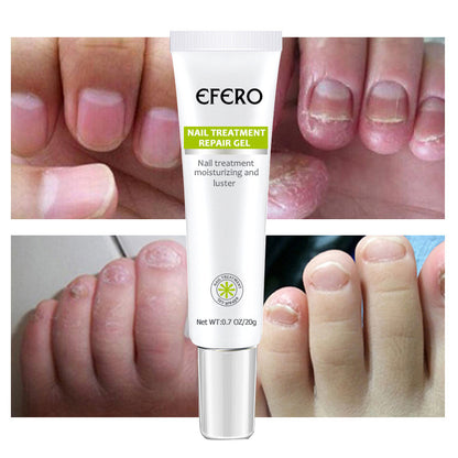 EFERO Nail Treatment Repair Cream Toe Be Health Instant Beauty Gel Cure Damaged Foot & Toenails Restores Appearance of Discolored or Damaged Nails