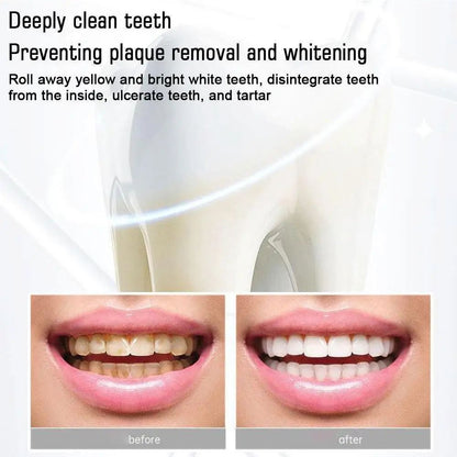 Probiotic Caries Toothpaste SP4 Whitening Repair Tooth Decay Paste Cleaner Teeth Remover Plaque Fresh Breath Oral Care