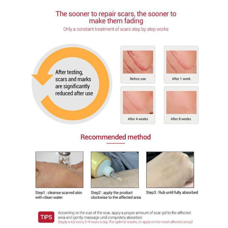 TCM Scar and Acne Mark Removal Gel Ointment Cream Removing Anti-inflammatory and Repairing - Pei mei