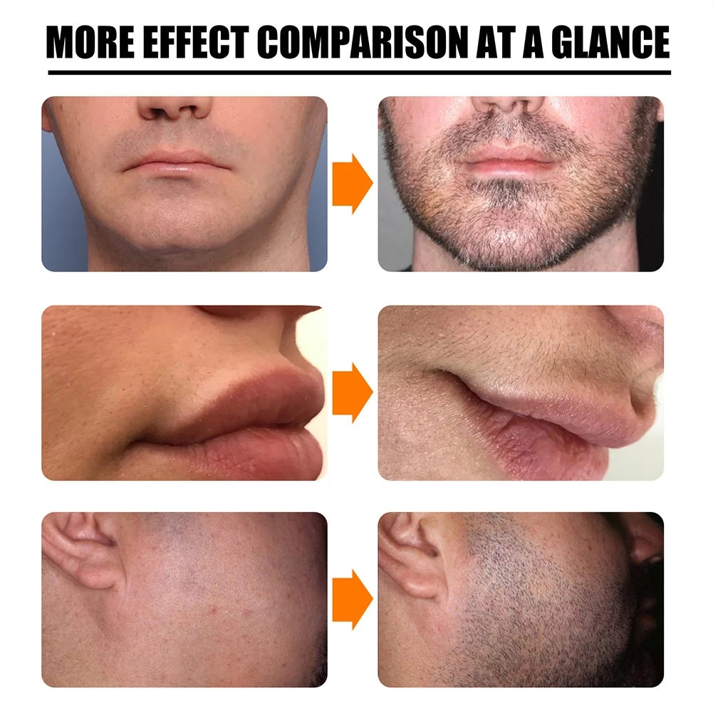 30ml Men Beard Growth Roller Set Beard Growth Kit Men's Beard Growth Essence Nourishing Enhancer Beard Oil Spray Beard Care